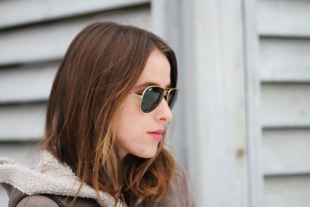 The Five Most Surprising Winter Accessories You Need Now 11 BScandolo010116-3