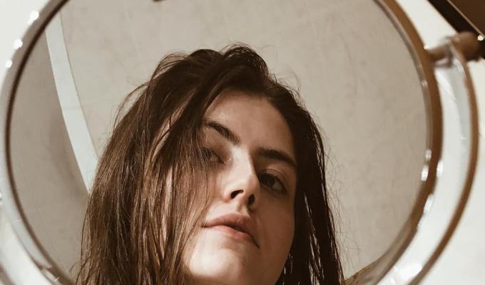 home remedies for acne scars