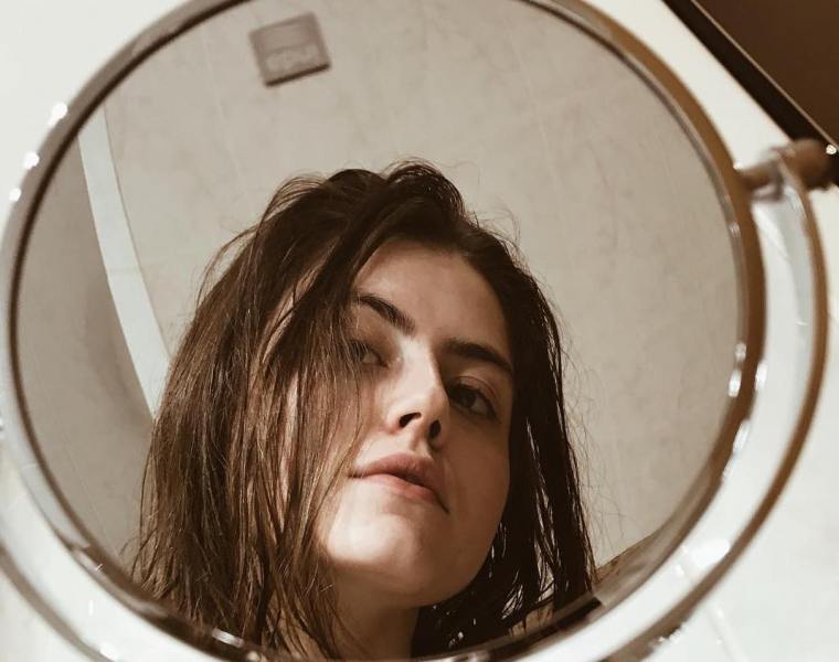 home remedies for acne scars